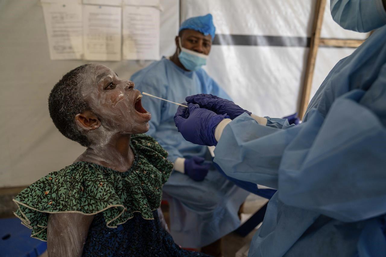 Congo's humanitarian crisis helped mpox spiral again into a global health emergency